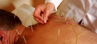 Kemoterapi ve akupunktur